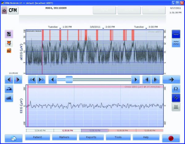 CFM Olympic Brainz Monitor - Image 3